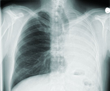 Radiologe Magnetresonanztomographie